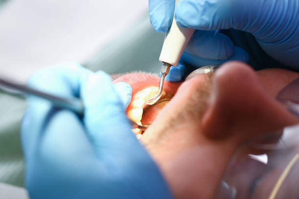 Best Pediatric Emergency Dentist in Waggaman, LA